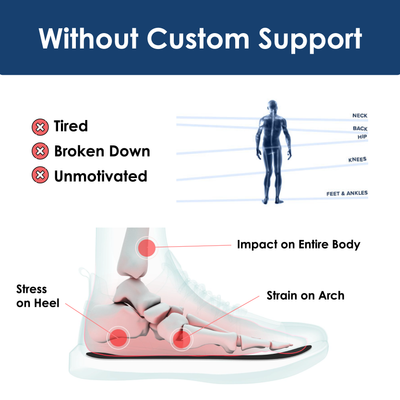 Shoely Custom Insoles (Trim to Fit)